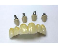 Purchase Best Zirconia Crown in China