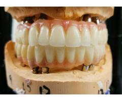 Custom Dental Implants from China