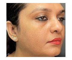 Best Cosmetic Services near by Bhubaneswar