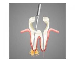 Root Canal Treatment Centre Mahwah Nj | Bergen-dentistry.com