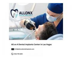 All on 4 Dental Implants Center in Las Vegas