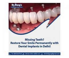 Missing Teeth? Restore Your Smile Permanently with Dental Implants in Delhi!
