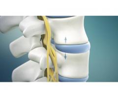 Spine Decompression: Ensuring Precision with Navigation Technology