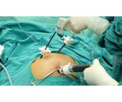 Top Surgeon for Gall Stone Treatment in Kolkata